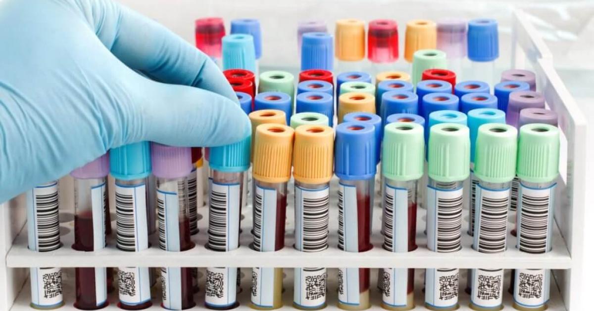 Гиперурикемия: причины, симптомы, лечение